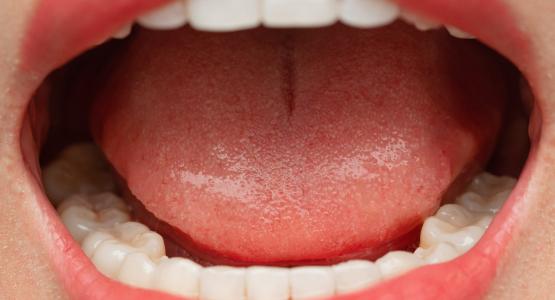 Denti del giudizio